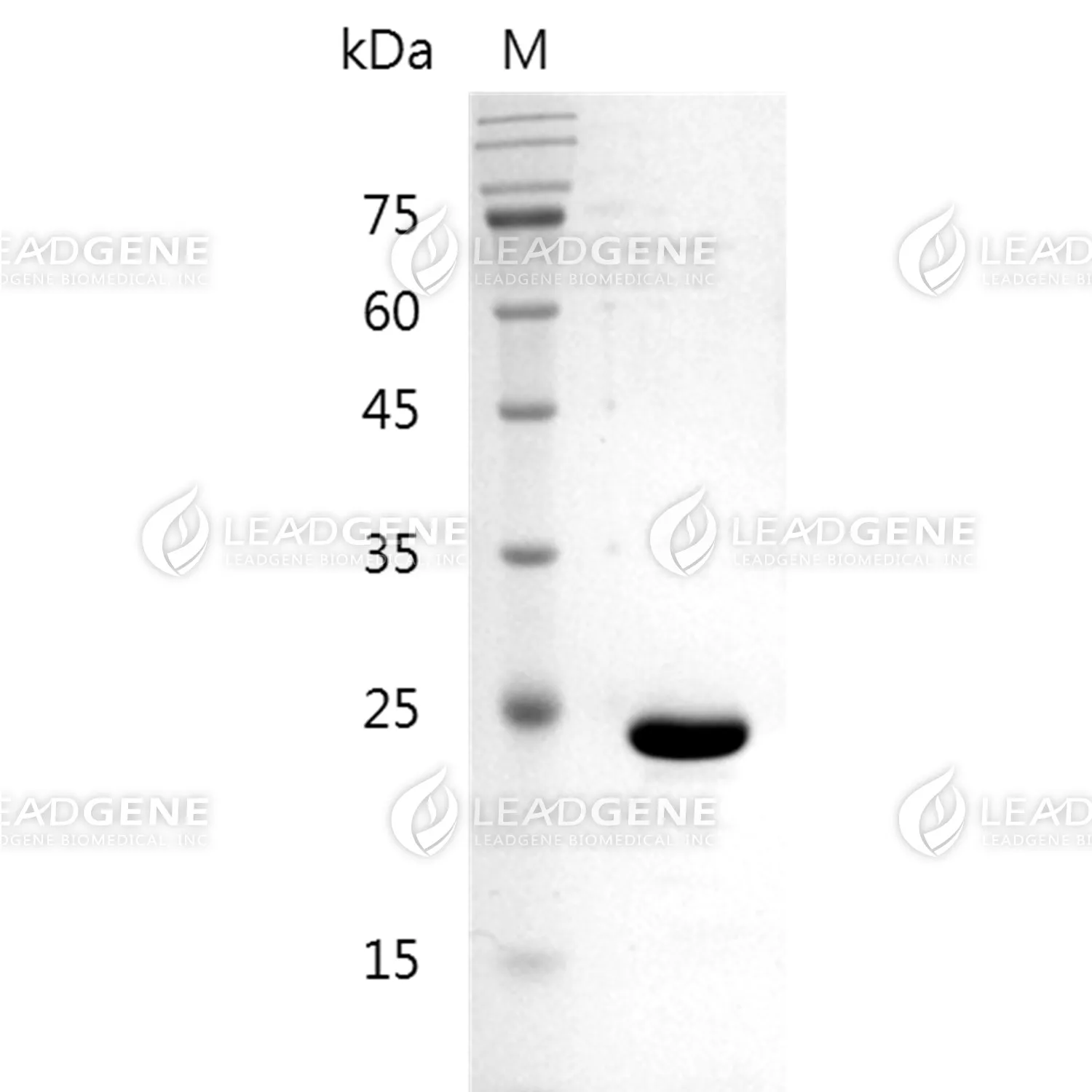 HIV-1 Capsid Protein p24, His Tag, E. coli